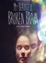 My Beautiful Broken Brain Film 2014   My Beautiful Broken Brain 1 11371356 D 